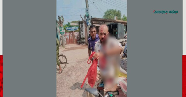 কুষ্টিয়ায় রাস্তা নির্মাণে অনিয়মের তথ্য সংগ্রহকালে সাংবাদিককে কুপিয়ে জখম
