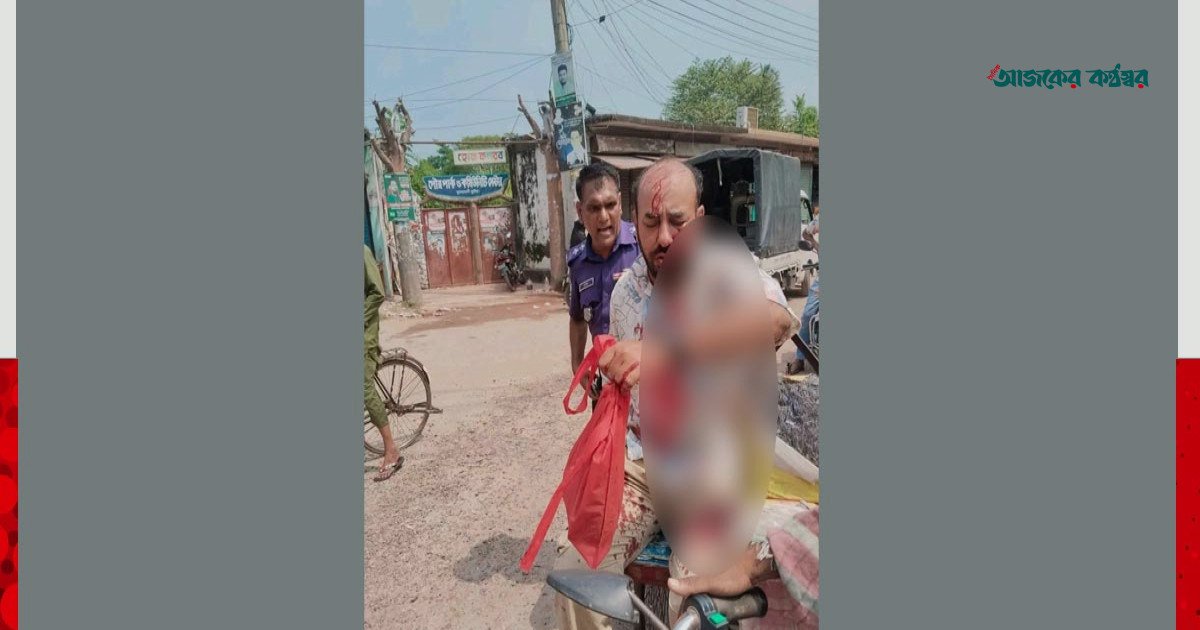কুষ্টিয়ায় রাস্তা নির্মাণে অনিয়মের তথ্য সংগ্রহকালে সাংবাদিককে কুপিয়ে জখম