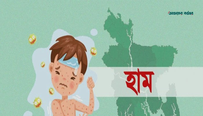 দেশে হাম ও উপসর্গে ২৪ ঘণ্টায় আরও ১১ জনের মৃত্যু