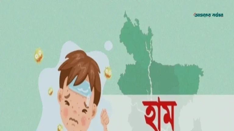 হাম ও উপসর্গে দেশে মৃতের সংখ্যা প্রায় দুই হাজার