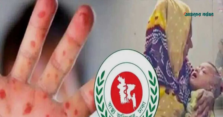 দেশে ২৪ ঘণ্টায় হামের উপসর্গে আরও ৭ শিশুর মৃত্যু, মোট প্রাণহানি ১২১৪
