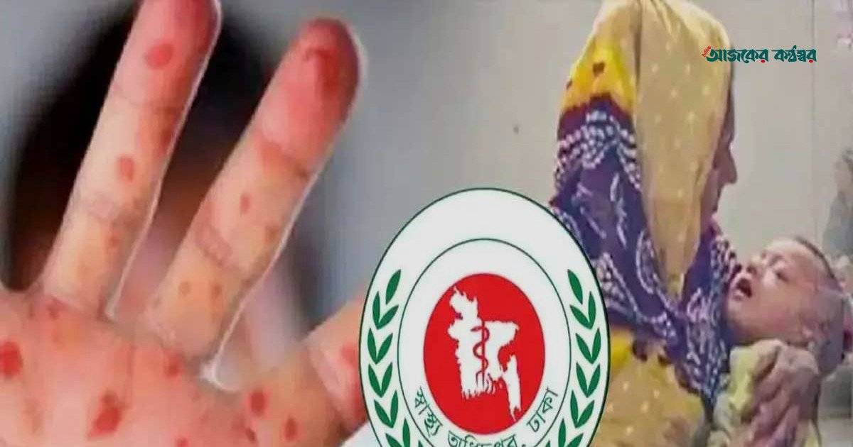 দেশে ২৪ ঘণ্টায় হামের উপসর্গে আরও ৭ শিশুর মৃত্যু, মোট প্রাণহানি ১২১৪