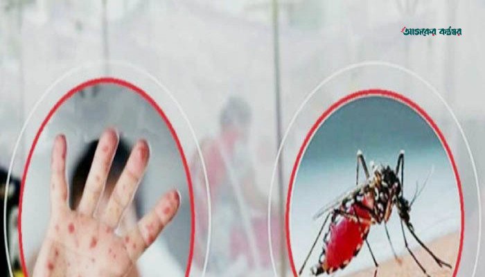 দেশে ২৪ ঘণ্টায় হামের উপসর্গে ৭ ও ডেঙ্গুতে ৪ মৃত্যু